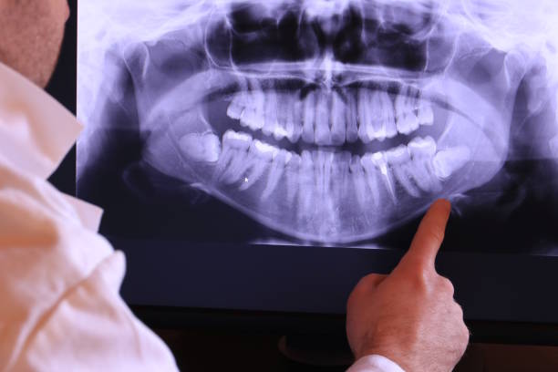 Best Emergency Root Canal Therapy in Dexter, MI
