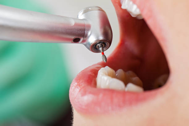 Best Urgent Dental Care for Toothaches in Dexter, MI